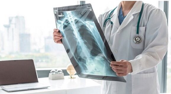 X izpien diagnostikoa ezkerreko omoplatoaren azpian dagoen mina
