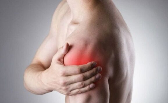 artritis glenohumeral ezkerreko omoplatoaren azpian bizkarreko minaren kausa gisa