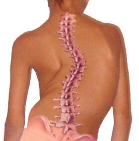 Bizkarrezurreko kurbadurak osteokondrosia dakar